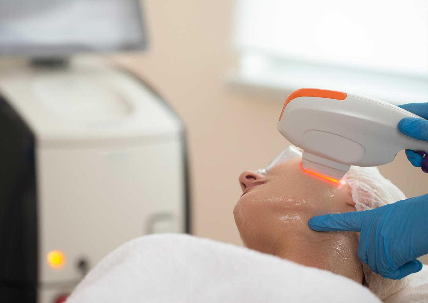 ipl ansiktsbehandling