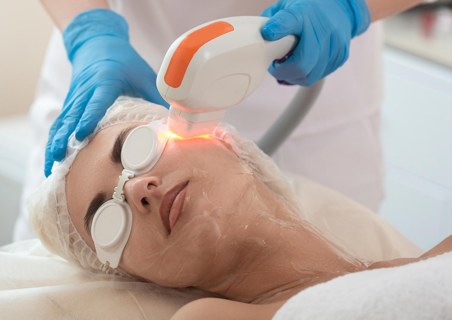 ipl ansiktsbehandling i stockholm